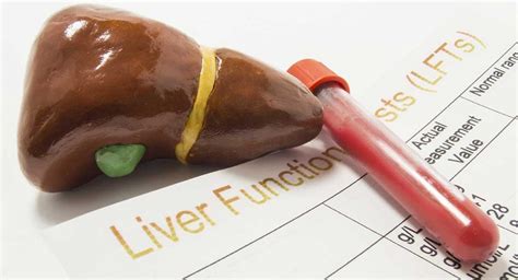 how to test to see if liver is hard|blood tests for liver damage.